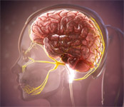 migraña crónica, cerebro y nervio trigemino